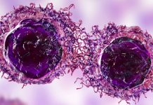 Deteccion di cancer “Santo Grial” ta pronostica tumor un aña prome cu nan forma