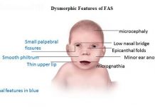Uso di alcohol ta keda un problema pa hobennan cu ta sali na estado