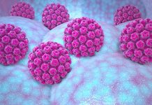 Descubrimento: Malesa HPV ta causa mas cancer cu bo ta realisa