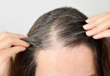 Investigadonan ta descubri cu stemcel “pega” por causa cabey blanco