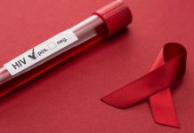 Pashentnan Hulandes ainda ta muri di AIDS pa via di diagnosis di HIV laat