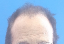 Gilbert Augustine Brown