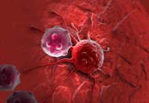 Estudio: Testnan nobo ta descubri mas etapa previo di cancer di tripa