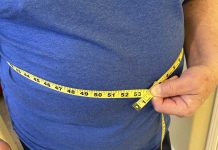 Obesidad no lo ser solamente defini cu BMI bao plan nobo pa diagnosis