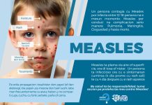Con Measles (sarampi) ta transmiti su mes