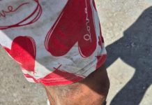 Hyungmin Seo gebeten zonder dat instanties verantwoordelijkheid nemen; Aanval op toerist toont groot falen in aanpak van zwerfhonden op Aruba