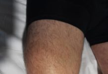 Experiencia di ciudadano ta pone luz riba negligencia medico na Aruba