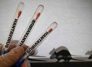 DVG: No tin motibo di preocupacion pa Aruba relaciona cu hantavirus