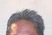 Norberto F. Orara